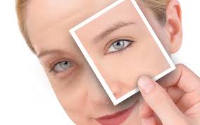 images 93 Treat Puffy Eyes With 5 Simple Steps